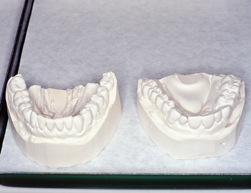 Dental Plaster
